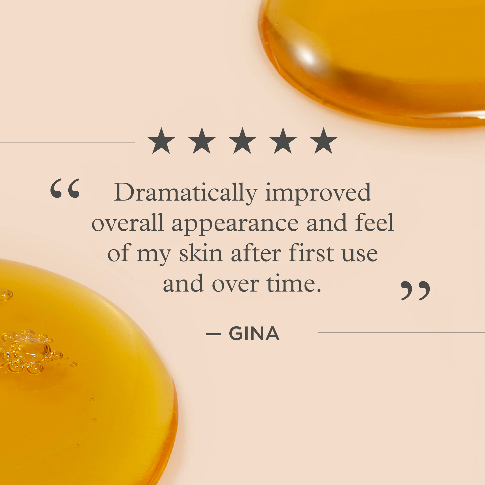 בוסטר רוזהיפ – תמונה 5